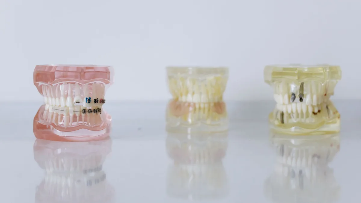 Close-up of dental models displaying braces and dentures for orthodontic education.