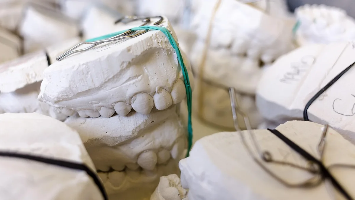 teeth, models, gypsum, dentist, dental, dentistry, dentist, dentist, dental, dental, dental, dental, dental